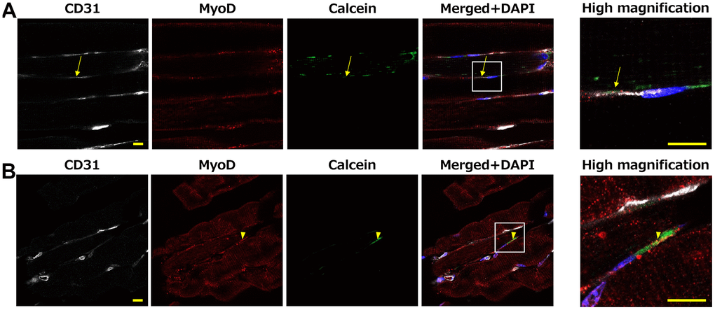 Mouse muscle at 10 minutes after Calcein loaded WBC intravenous injection. Calcein signals were observed in the muscle tissue, including CD31-positive endothelial cells (A: arrow) and MyoD-positive satellite cells (B: arrowhead). High-magnification images of the white squares are shown in right panel. Scale bar = 10 μm (A, B.; left and right panels).