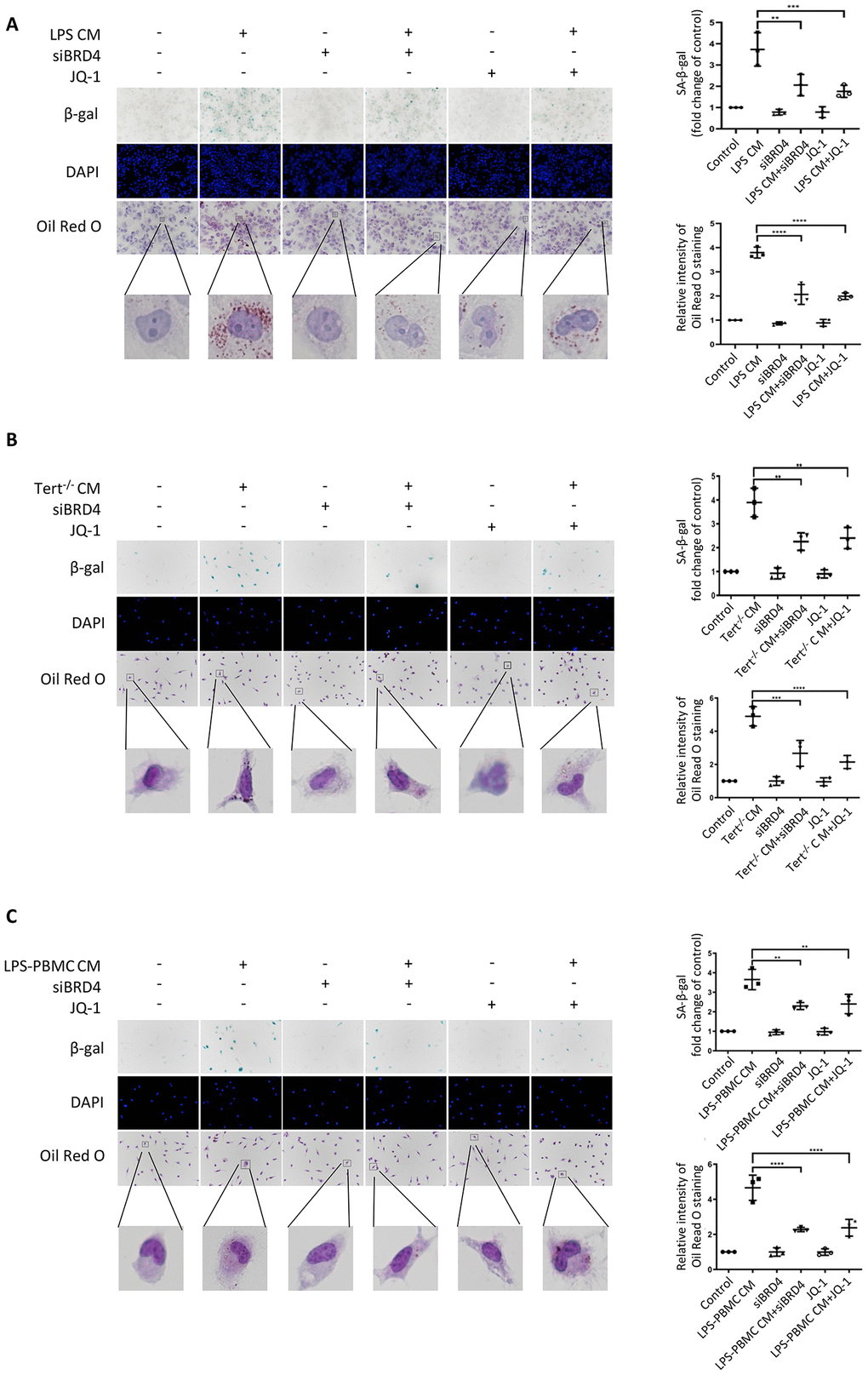 BRD4-induced inflammation reinforces the senescent phenotype via paracrine pathways. (A) THP-1 macrophages were cultured with LPS-induced senescent cell-derived conditioned medium for 24 h with or without siBRD4 or the BRD4 inhibitor JQ-1 (1 µM). Representative SA-β-gal was used to detect cell senescence, and Oil Red O staining was used to detect lipid accumulation in the cells. Scale bar, 50 µm. (B, C) The peritoneal macrophages from the Tert−/− mice and human peripheral blood mononuclear cells (PBMCs) were cultured with the corresponding conditioned medium for 24 h. Representative SA-β-gal was used to detect cell senescence, and Oil Red O staining was used to detect lipid accumulation in the cells. Scale bar, 50 µm. The data all represent measured data presented as the mean ± SD. Comparisons between multiple groups were performed using one-way ANOVA, followed by Tukey’s post-hoc test. The experiment was repeated three times. Significant differences among different groups are indicated as **p ***p −/− CM; ****p 