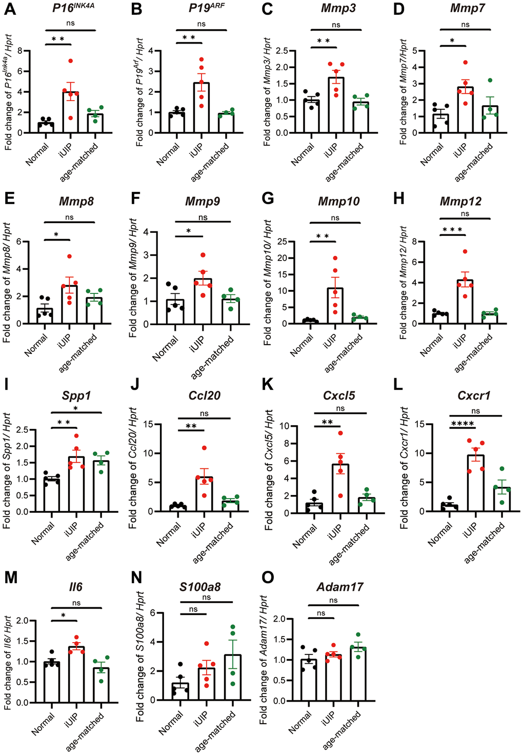 Lungs with iUIP were already in senescence state. Total RNA was extracted from iUIP, normal mice (healthy control mice with the same genetic background as iUIP mice), and age-matched control lungs. P16INK4A (A), P19ARF (B), Mmp3 (C), Mmp7 (D), Mmp8 (E), Mmp9 (F), Mmp10 (G), Mmp12 (H), Spp1 (I), Ccl20 (J), Cxcl5 (K), Cxcr1 (L), Il6 (M), S100a8 (N), and Adam17 (O) expression as determined by qPCR. Hprt served as an internal control. The results are shown as mean ± SE of five mice at normal and iUIP and four mice at age-matched control. Asterisks indicate *P **P ***P ****P 