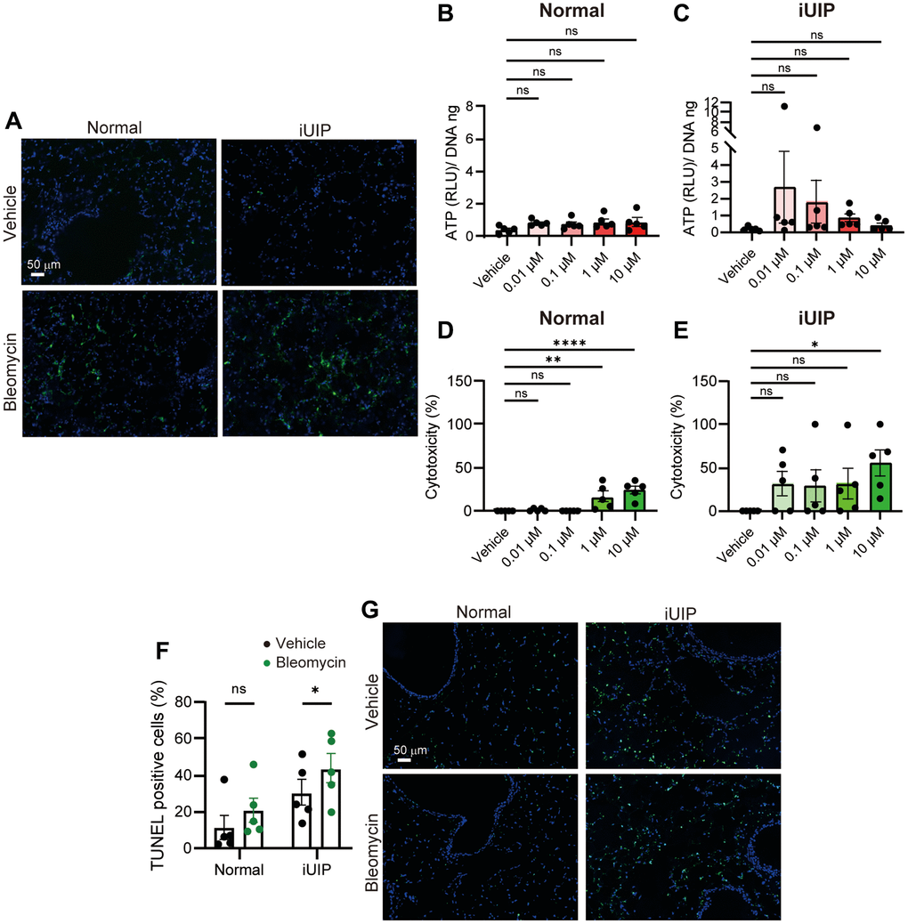 Cellular cytotoxicity was induced by bleomycin treatment in PCLS from iUIP mice. (A) ROS generation was detected in PCLS from normal and iUIP mice treated with the vehicle or 1 μΜ bleomycin for 30 min. (B, C) Extracellular ATP was examined in PCLS from normal (B) and iUIP (C) treated with the vehicle or 0.01–10 μΜ bleomycin for 4 h. Values were normalized to DNA content. (D, E) LDH assay was examined in PCLS from normal (D) and iUIP (E) treated with the vehicle or 0.01–10 μM bleomycin for 48 h. Values were normalized to DNA content. (F, G) PCLS samples were treated with 1(μM bleomycin for 120 h. TUNEL-positive cells in paraffin-embedded sections were stained and calculated based on the total number of cells. The results are shown as mean ± SE of five mouse PCLSs at each stage. Asterisks indicate *P **P ****P 