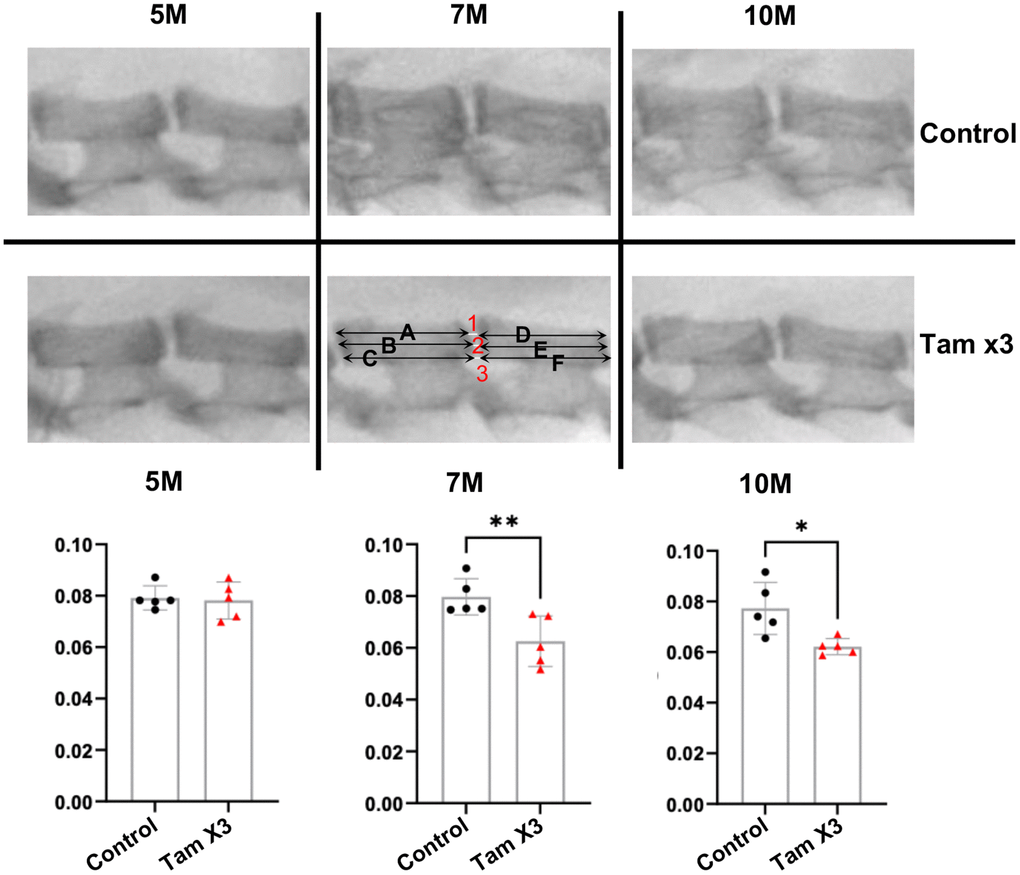 Runx1 overexpression reduced disc height index at 7M and 10M. Disc height index (DHI) was determined according to the following equation: DHI = 2 x (DH1 + DH2 + DH3) / (A + B + C + D + E + F). DH represents the disc height between adjacent vertebrae and the letter represents the length of vertebral bone. The DHI at the L4/5 level showed no significant alteration at 5M. However, a substantial reduction was evident in the Tam X3 group at both 7M and 10M, compared to the control group. n = 5 mice /group. Student t-test was performed. (** p 