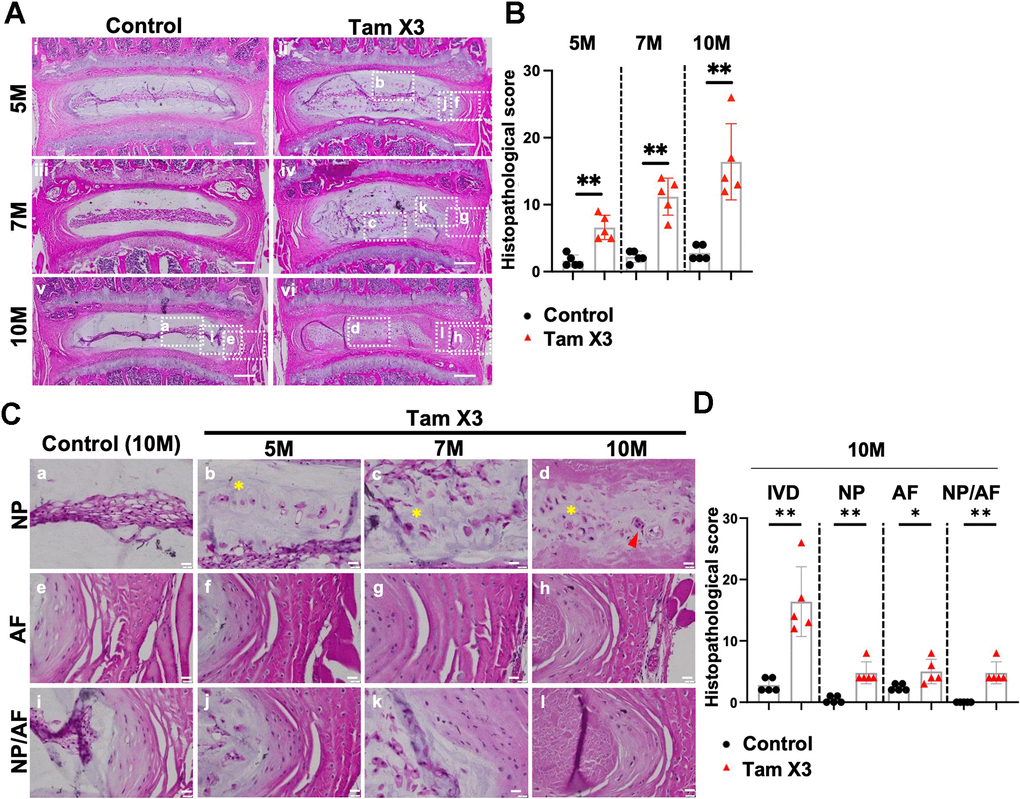 Runx1 overexpression induced age-related intervertebral disc degeneration. (A) Representative images of Hematoxylin and eosin (H&E) staining in the IVDs of control and Runx1 overexpression (Tam X3) mice at 5M, 7M, and 10M. Control mice showed a highly organized IVD structure. The IVDs of Runx1 overexpression (Tam X3) mice showed progressive IVD structure degeneration over time. Scale bar = 200 μm. (B) Total IVD histopathological scores in the IVDs of control and Runx1 overexpression (Tam X3) mice at 5M, 7M, and 10M. Student’s t-test was performed. (** p Supplementary Figure 2 used the same representative images for control and Tam X3 groups as in Figure 3. Since our primary objective was to assess the consequence of Runx1 overexpression on disc aging, we elected to focus the rest of our studies on the highest Runx1 overexpressing mice, which corresponds to the Tam X3 group. (C) Higher magnification of H&E images in the NP, AF and NP/AF boundary in the control and Runx1 overexpression (Tam X3) mice. The control NP comprised of tightly connected notochordal cells in the center. The AF tissue was well organized with a distinct boundary between NP and AF tissues. The IVDs of Runx1 overexpression mice showed multiple nuclei in NP cells and the appearance of cell clusters (d) and disorganized extracellular matrix in the NP, with the presence of round-shaped cells in the inner AF over time. Scale bar = 20 μm. Asterisk indicates disorganized extracellular matrix. Arrowhead indicates cell clusters. (D) Compartment-specific histopathological scores in the IVDs of control and Runx1 overexpression (Tam X3) mice at 10M. The scores were significantly increased in all compartments of Runx1 overexpression mice at 10M, compared to the control. n = 5 mice/group. Student’s t-test was performed (** p 