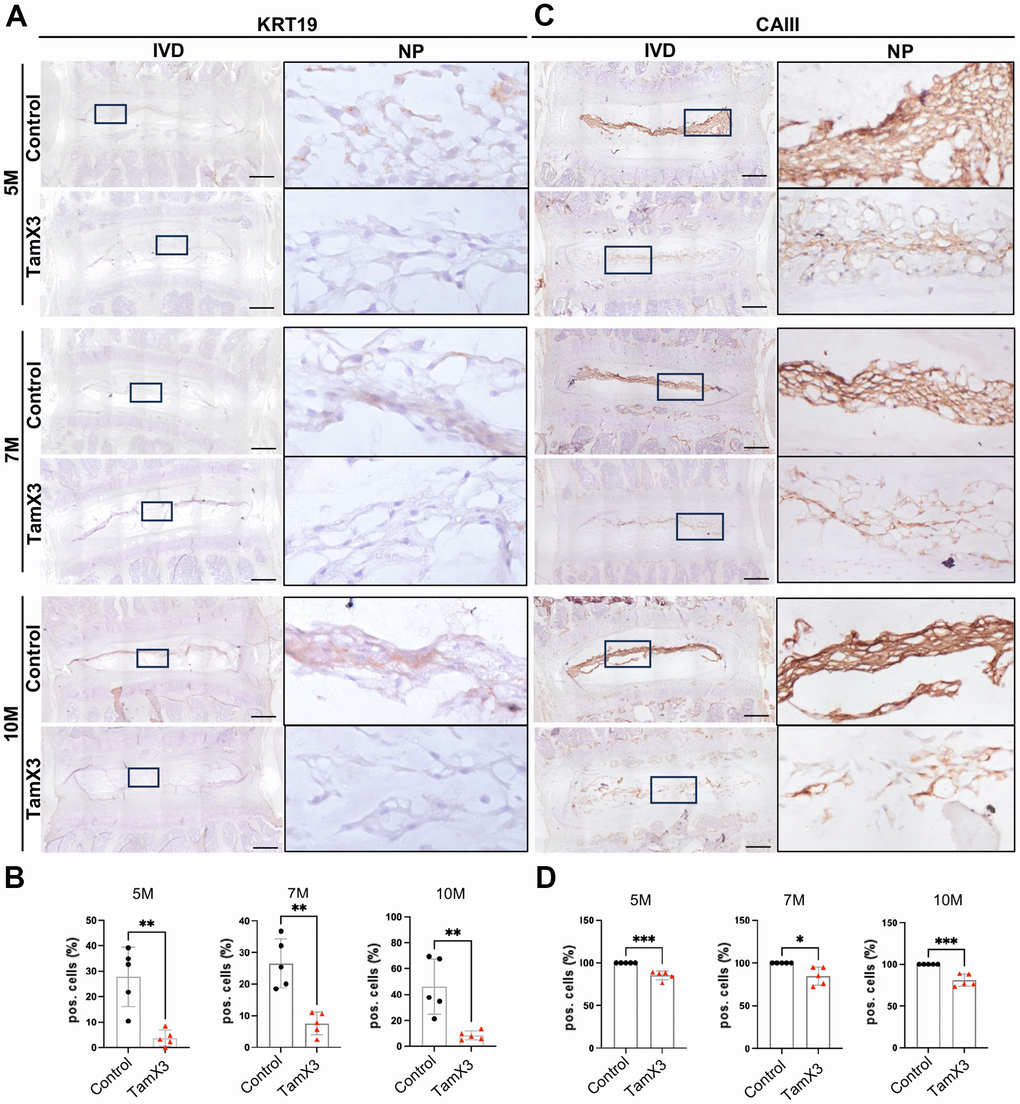 Runx1 overexpression caused the loss of notochordal cell phenotype. (A, C) Representative images of immunohistochemistry staining of notochordal cell marker KRT19 (A) and CAIII (C) at 5M, 7M, and 10M. Scale bar = 200 μm. Magnified NP areas are shown. Hematoxylin was used as nuclei staining and immunopositivity was labeled brown. (B, D) Quantification results showing that the KRT19 (B) and CAIII (D) positive cells were significantly decreased in the NP of Runx1 overexpression mice in all the timepoints examined. n = 5 mice /group. Student’s t-test was performed (* p 