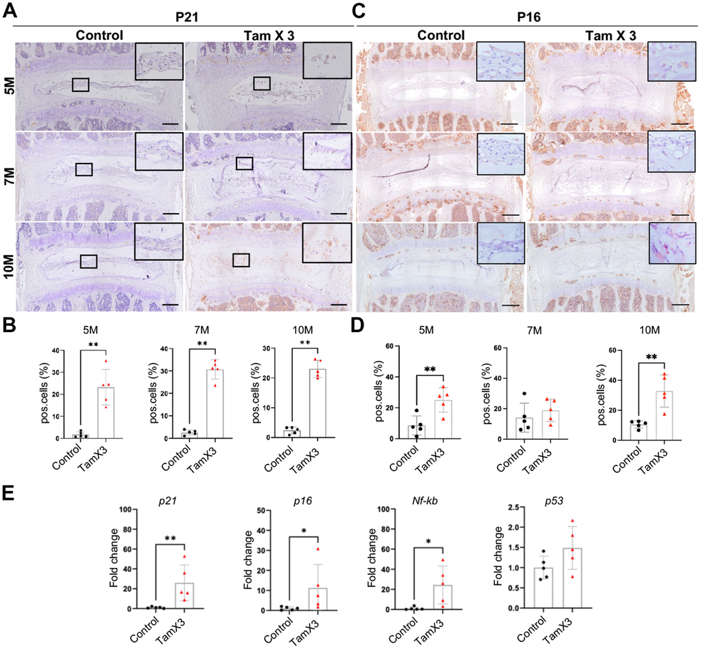 Runx1 overexpression induced NP cell senescence. (A, C) Immunohistochemistry staining for P21 (A) and P16 (B) was conducted to detect the presence of cell senescence in the NP. Scale bar = 200μm. (B, D) Quantification analysis showed that substantial increase in the ratio of P21 positive cells in Runx1 overexpression mice. P16 positive cells were increased significantly at 5M and 10M but not at 7M. n = 5 mice /group. Student’s t-test was performed (** p E) The gene expression analysis demonstrated the increased levels of p21, p16, and Nf-kb in Runx1 overexpression mice at 10M. The expression level of p53 remained unchanged in the Runx1 overexpression mice. n = 5 mice /group. Student’s t-test was performed (** p 