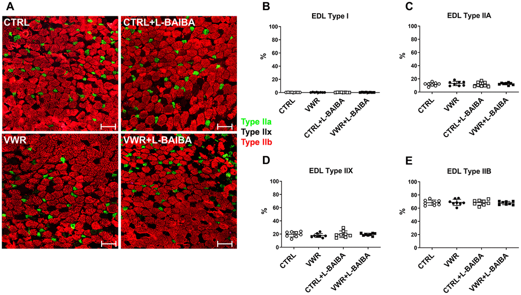 EDL muscle fiber type analysis after the three-month intervention period. (A) Representative images of EDL muscle histological sections stained for type I (pink), type IIA (green), type IIX (no staining), or type IIB (red) myosin heavy chain. The scale bars represent 100 μm. Quantitation of the percentage of type I (B), type IIA (C), type IIX (D), or type IIB (E) myofibers. One-way ANOVA, p>0.05. n = 8 CTRL, n = 8 VWR, n = 8 CTRL+L-BAIBA, n = 8 VWR+L-BAIBA. Mean ± SD.