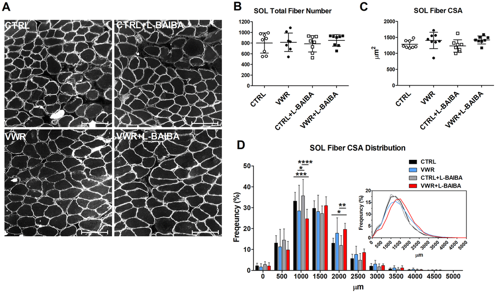Soleus muscle fiber cross-sectional area after the three-month intervention period. (A) Representative images of soleus (SOL) muscle histological sections stained for dystrophin for quantitation of myofibers. The scale bar represents 100 μm. (B) Quantitation of the total number of SOL myofibers. (C) Average SOL myofiber cross-sectional area (CSA). (D) The frequency distribution of SOL myofiber CSA. Inlay: Superimposed myofiber frequency distribution curves at 250 μm binning. ****pppp