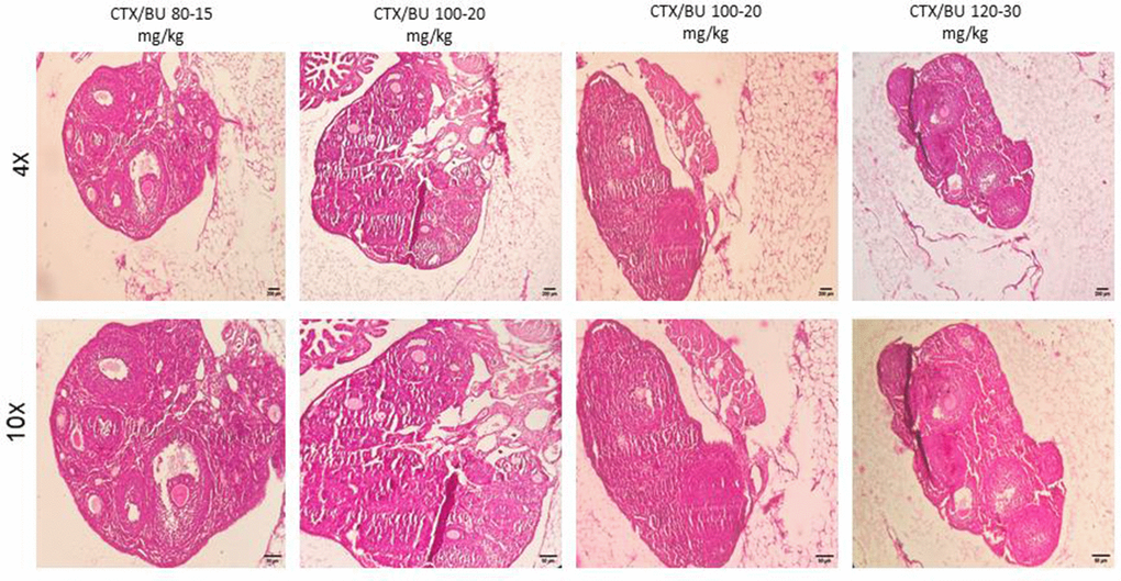 POF failure (POF) in NMRI female 6-8 weeks mice. Dose-response of ovarian follicles destruction by Cyclophosphamide (CTX: 80, 100, 120mg/Kg) and Busulfan (Bu: 15, 20, 12, 30 mg/Kg) for 4 weeks, observed at different magnifications (4× = 40×, 10× = 100×).