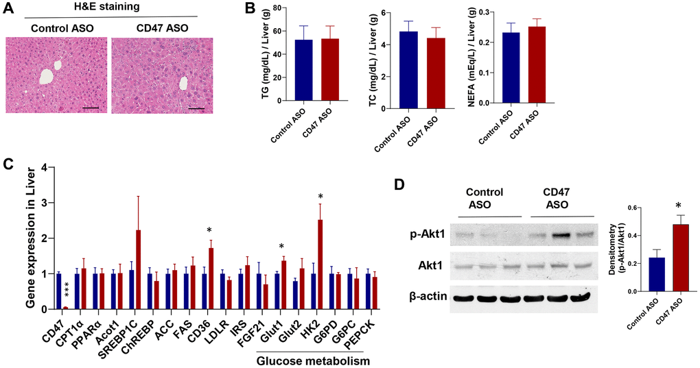 Effect of CD47 ASO treatment on liver histology and gene expression in aged male mice. (A) Representative H&E staining image of liver (scale bar = 100 μm); (B) Hepatic lipid levels including triglycerides, total cholesterol, and free fatty acid; (C) Gene expression in liver by qPCR; (D) Representative hepatic immunoblotting of p-AKT1, total AKT, and β-actin, with corresponding densitometry results. Data are represented as mean ± SEM (n = 6 mice/group). *P ***P 